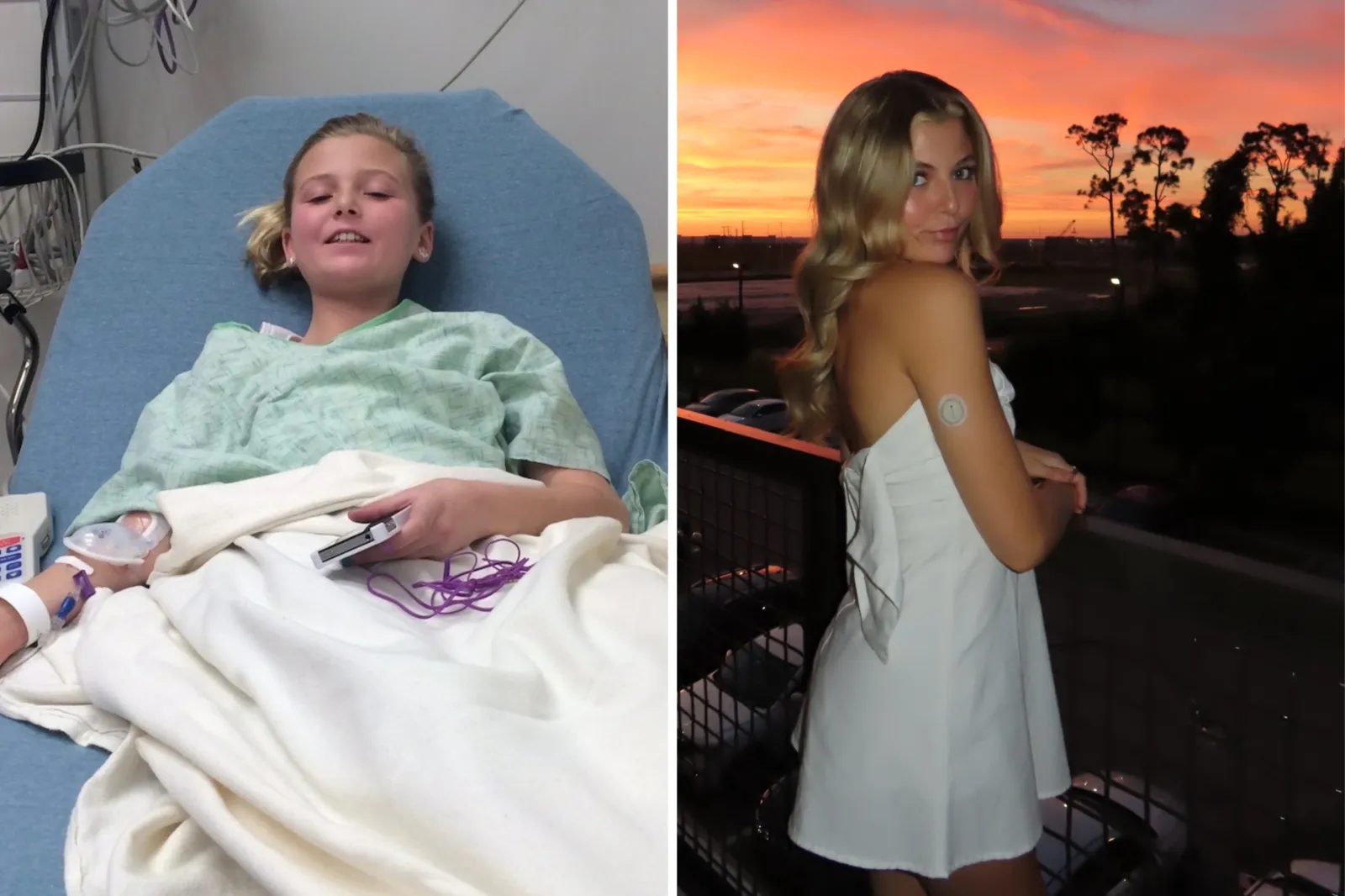 Caitlin Neelley as a child in hospital, and right, as an adult with a glucose monitor.
