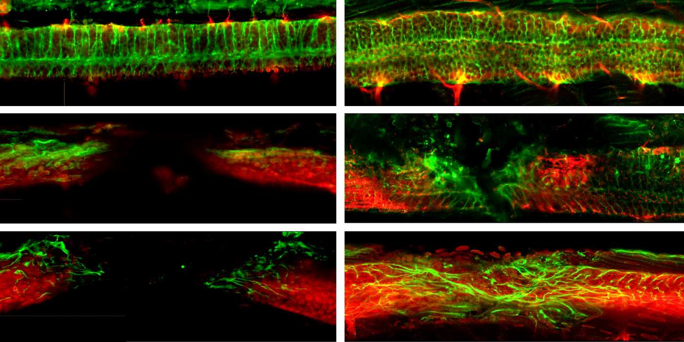 Mouse with Severed Spinal Cord Recovers ‘Normal’ Movement After Potentially Revolutionary Treatment