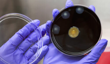 New York City Adopts Measures to Slow Legionnaires’ Disease Outbreak