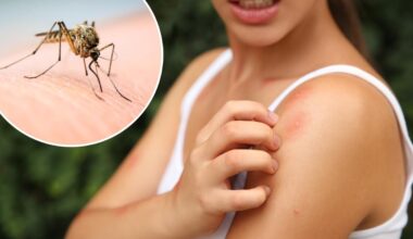 Scratching that bug bite might feel good at first but science says it’s a bad idea