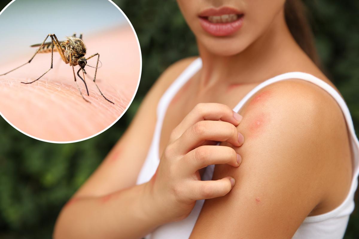 Scratching that bug bite might feel good at first but science says it’s a bad idea
