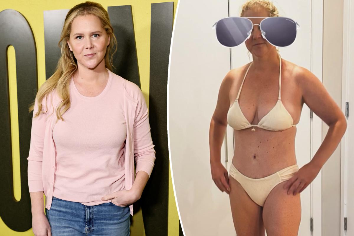Amy Schumer shows off C-section scar in tiny bikini, boasts that she's a 'Warrior'