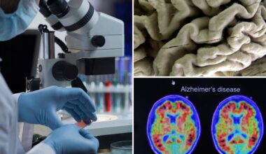 Alzheimer’s blood test may identify healthy people at high risk, study finds