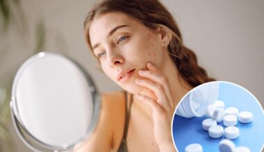 'Ferritin face,' the mineral deficiency messing with your looks