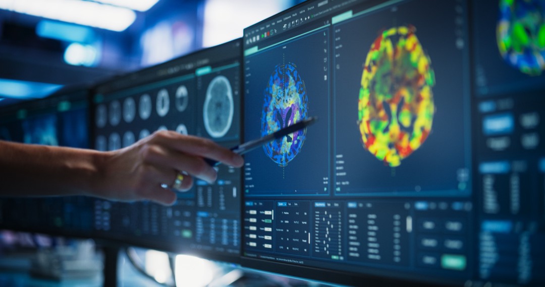 WHO: Global Cancer Cases May Surge Almost 70% by 2050