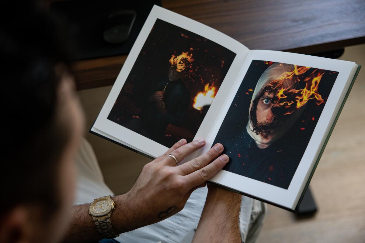 A hand presses open a book between photos of a burning head.