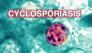 What is Cyclospora cayetanensis? CDC reports parasite causing stomach illness across US, including Texas