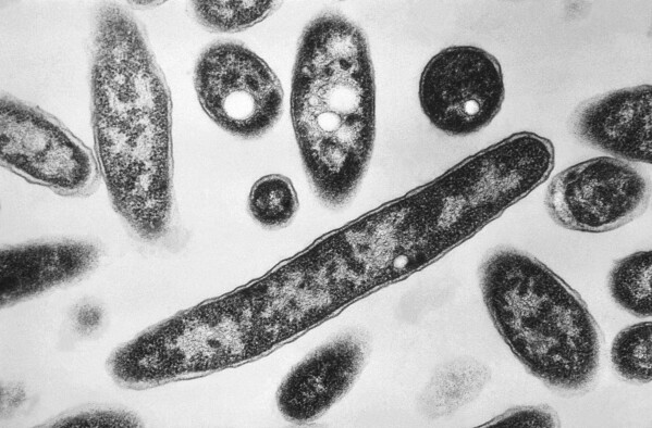 This 1978 electron microscope image made available by the Centers for Disease Control and Prevention shows Legionella pneumophila bacteria which are responsible for causing the pneumonic disease Legionnaires' disease. (Francis Chandler/CDC via AP, File)