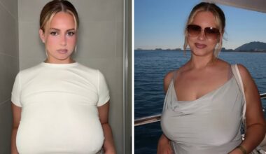 Woman Gets Life-Changing Breast Reduction From Size ’36G to 36C’