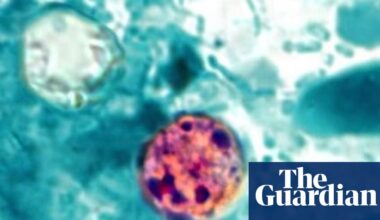 What is cyclosporiasis, the parasitic illness causing ‘explosive’ diarrhea? | US news