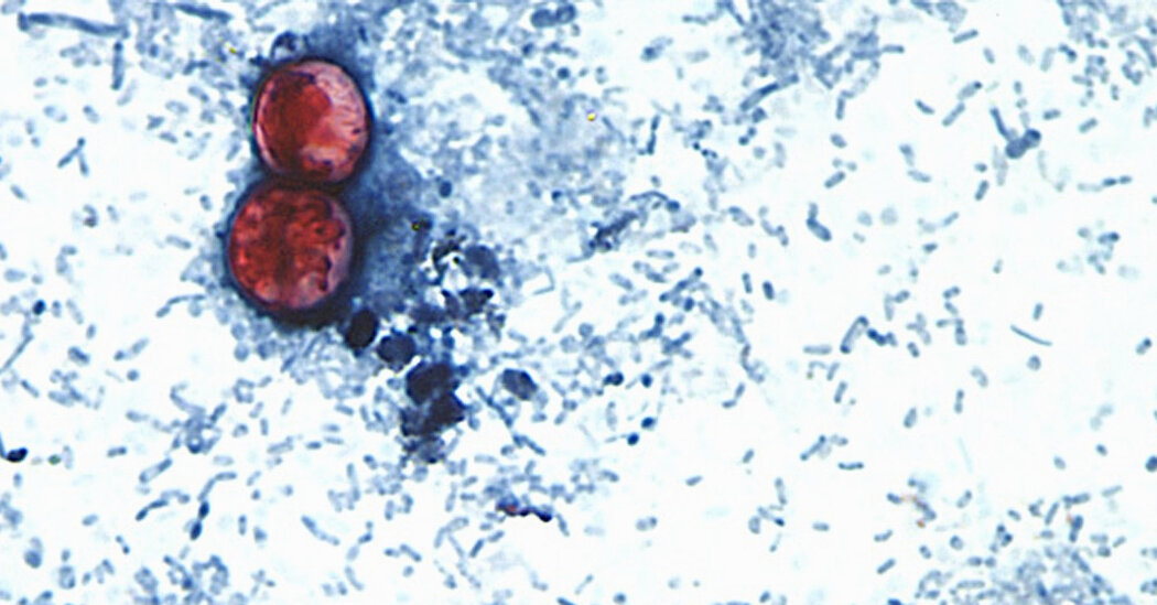 What the Cyclospora Outbreak Reveals