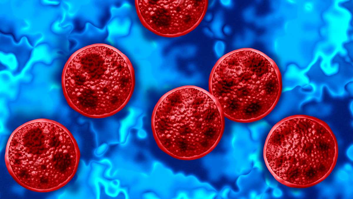 Cyclospora outbreak: Hamilton County reports additional cases