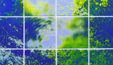 Extreme Dizziness but No Headache? It Could Be a Vestibular Migraine.