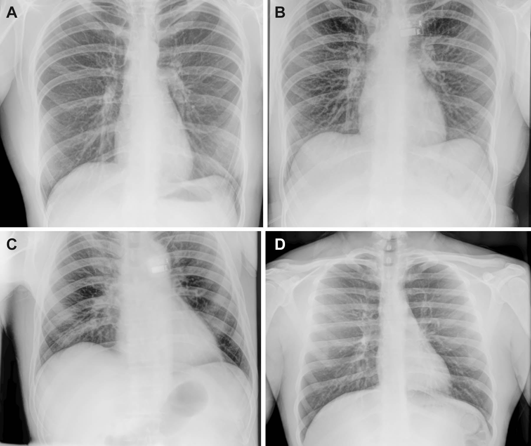 260258fig04