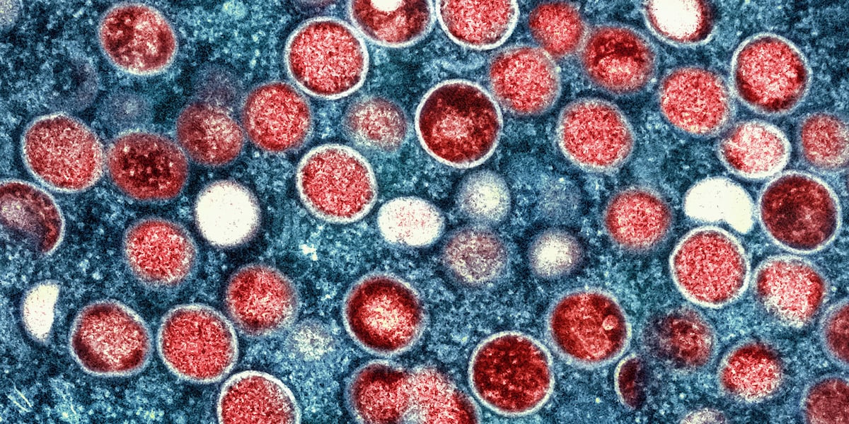 Health officials track Arizona’s first travel-associated case of Clade I mpox
