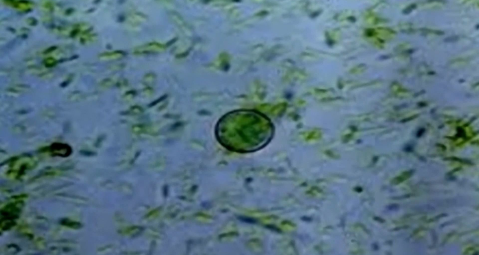 Explosive diarrhea? Here's what to know about Cyclospora :: WRAL.com