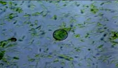 Explosive diarrhea? Here's what to know about Cyclospora :: WRAL.com