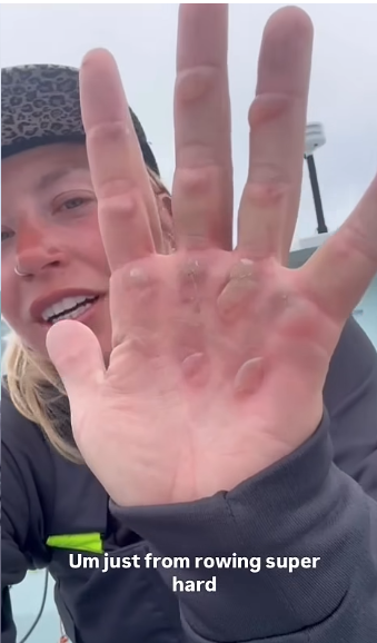 Blisters