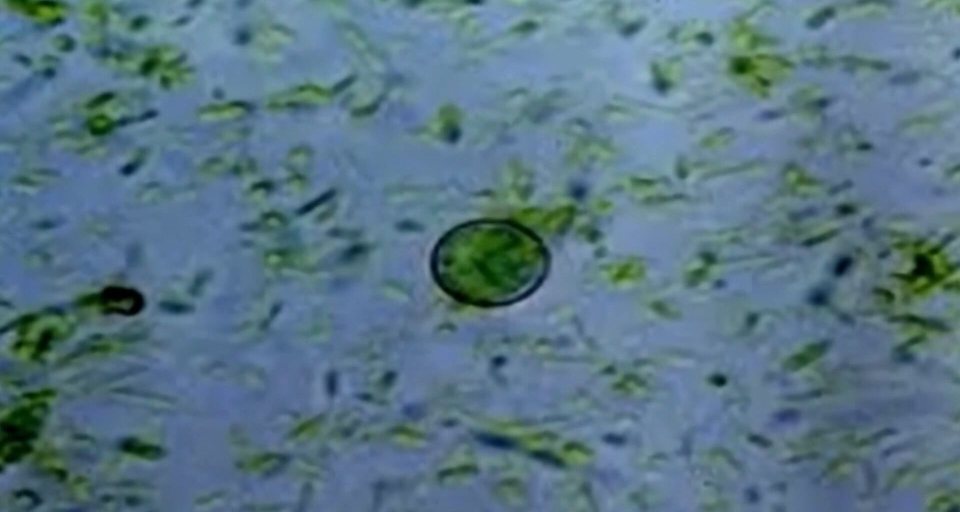 More than 60 North Carolina cases tied to parasite behind 'explosive diarrhea'