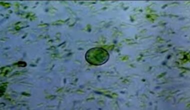 More than 60 North Carolina cases tied to parasite behind 'explosive diarrhea'