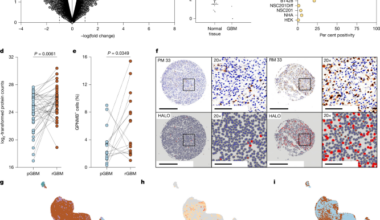 Dual tumour–myeloid targeting of glioblastoma with GPNMB CAR-T cells
