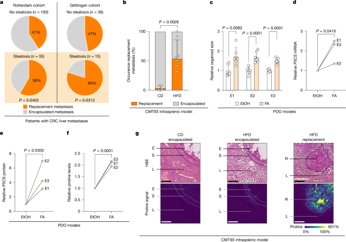 Steatosis shapes prognosis-defining liver metastasis heterogeneity in CRC