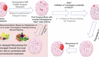 Low carbohydrate high fat diet curbs glioblastoma by shifting lipids and limiting cancer stem cell metabolic flexibility