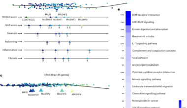 A data-driven framework reconstructs the molecular continuum of human MASLD progression