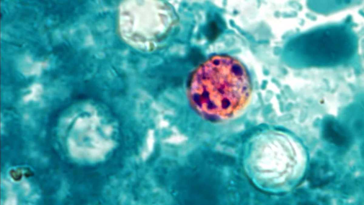 Oklahoma cyclosporiasis cases hit 172, OSDH says