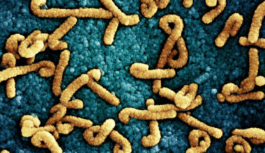 Marburg virus cases reported in Ugandan ebola outbreak area