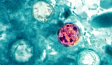 Kansas cases climb in ‘explosive diarrhea’ outbreak