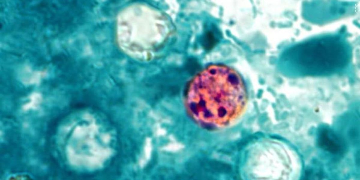 Kansas cases climb in ‘explosive diarrhea’ outbreak