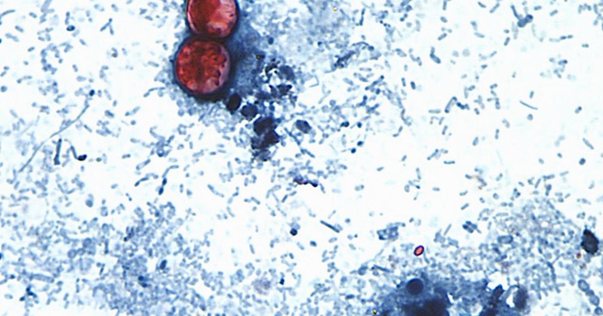 Northern Nevada Public Health reports first cyclosporiasis case in Washoe County | Local News