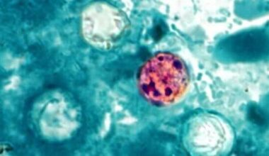 Delaware sees first Cyclosporiasis case in ongoing multistate outbreak | The Latest from WDEL News