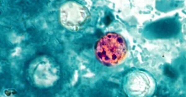 Delaware sees first Cyclosporiasis case in ongoing multistate outbreak | The Latest from WDEL News