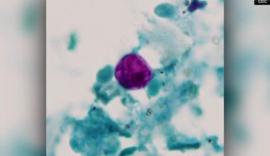 Cyclospora outbreak: 46 cases in New Jersey, 28 in Pennsylvania, including 5 cases in Bucks Co. | Pennsylvania News