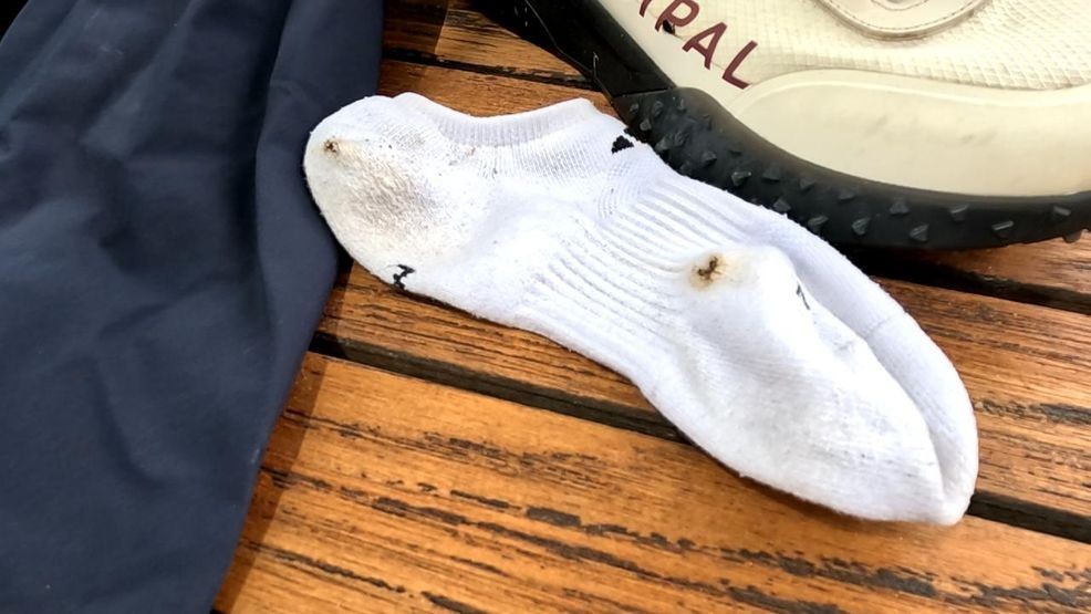 {p}William James was struck by lightning on the fifth hole atOregon Golf Club on Saturday, while playing a solo round. KATU got a look atthe clothing he was wearing at the time of the 1-in-a-million incident. (KATU) {/p}