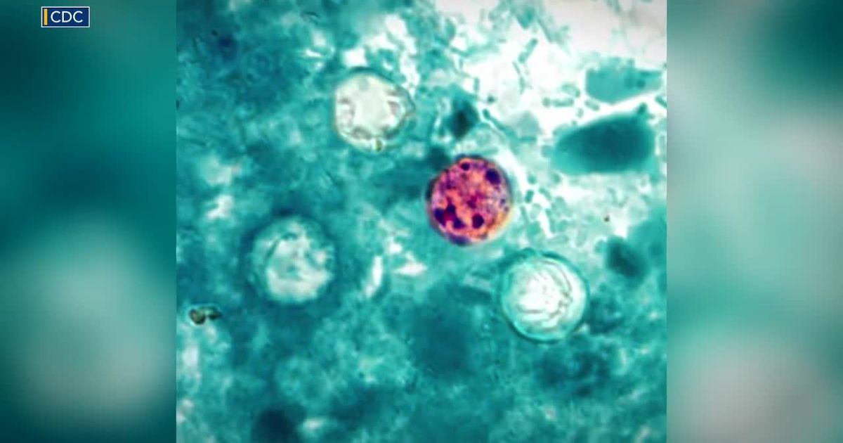More people are seeking Cyclospora tests. Here's what patients should know :: WRAL.com