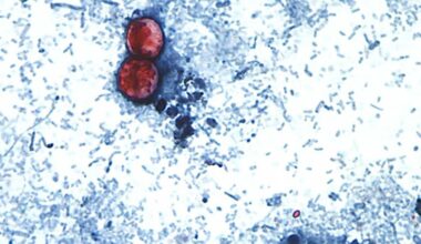 Parasitic infection causing diarrhea now in Kentucky