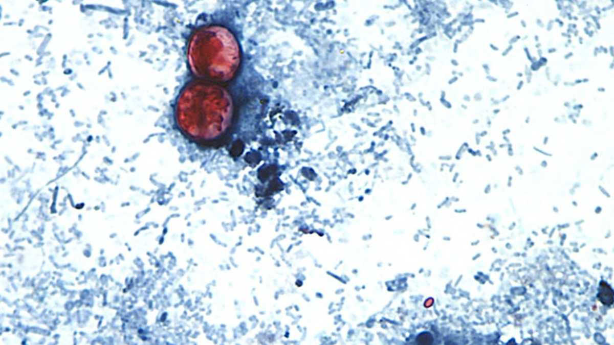 Parasitic infection causing diarrhea now in Kentucky