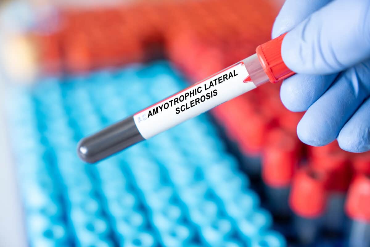 ALS blood test