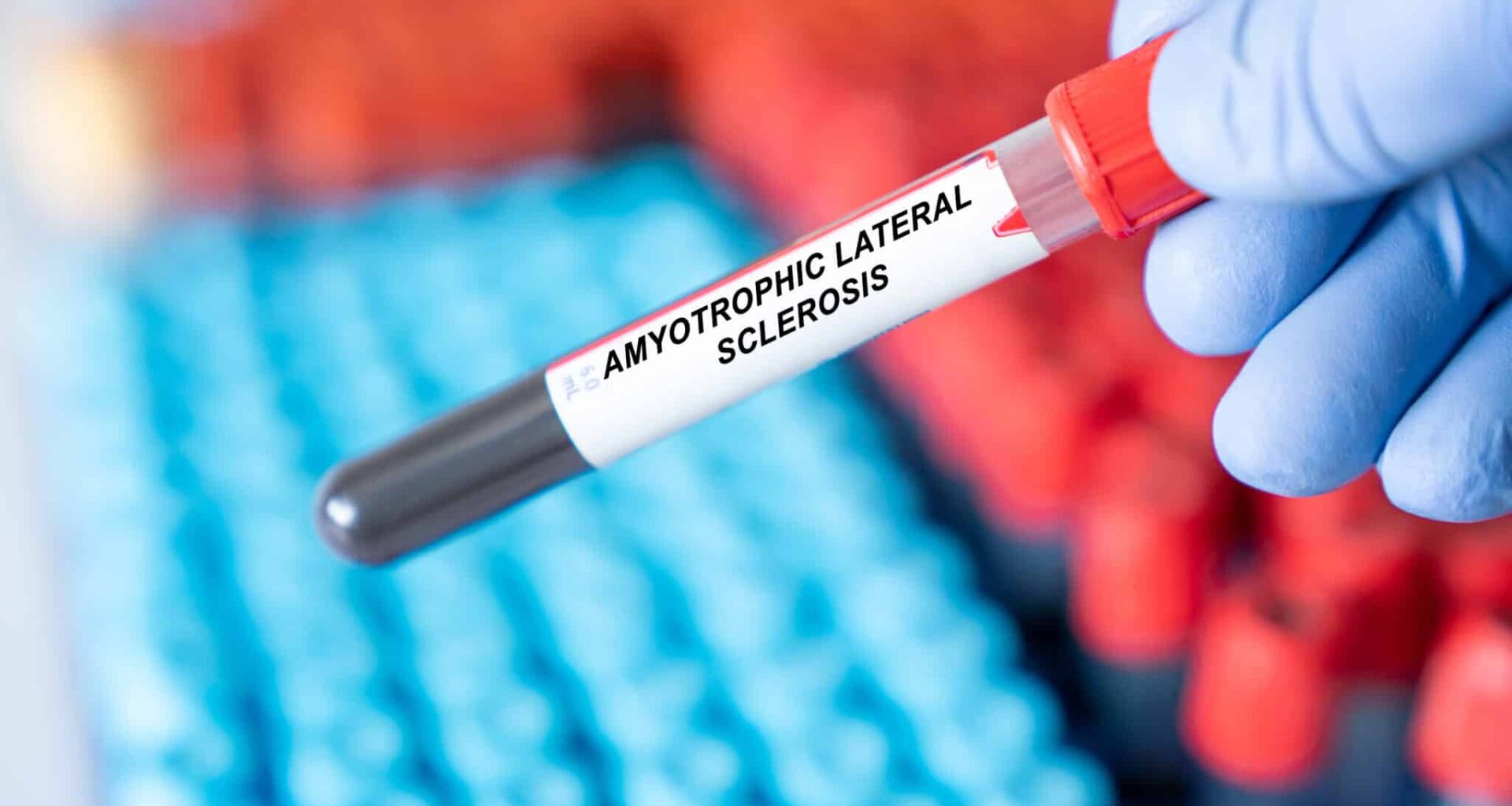 Can Blood Tests Predict ALS Before It Strikes? Here's What Scientists Found