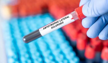 Can Blood Tests Predict ALS Before It Strikes? Here's What Scientists Found