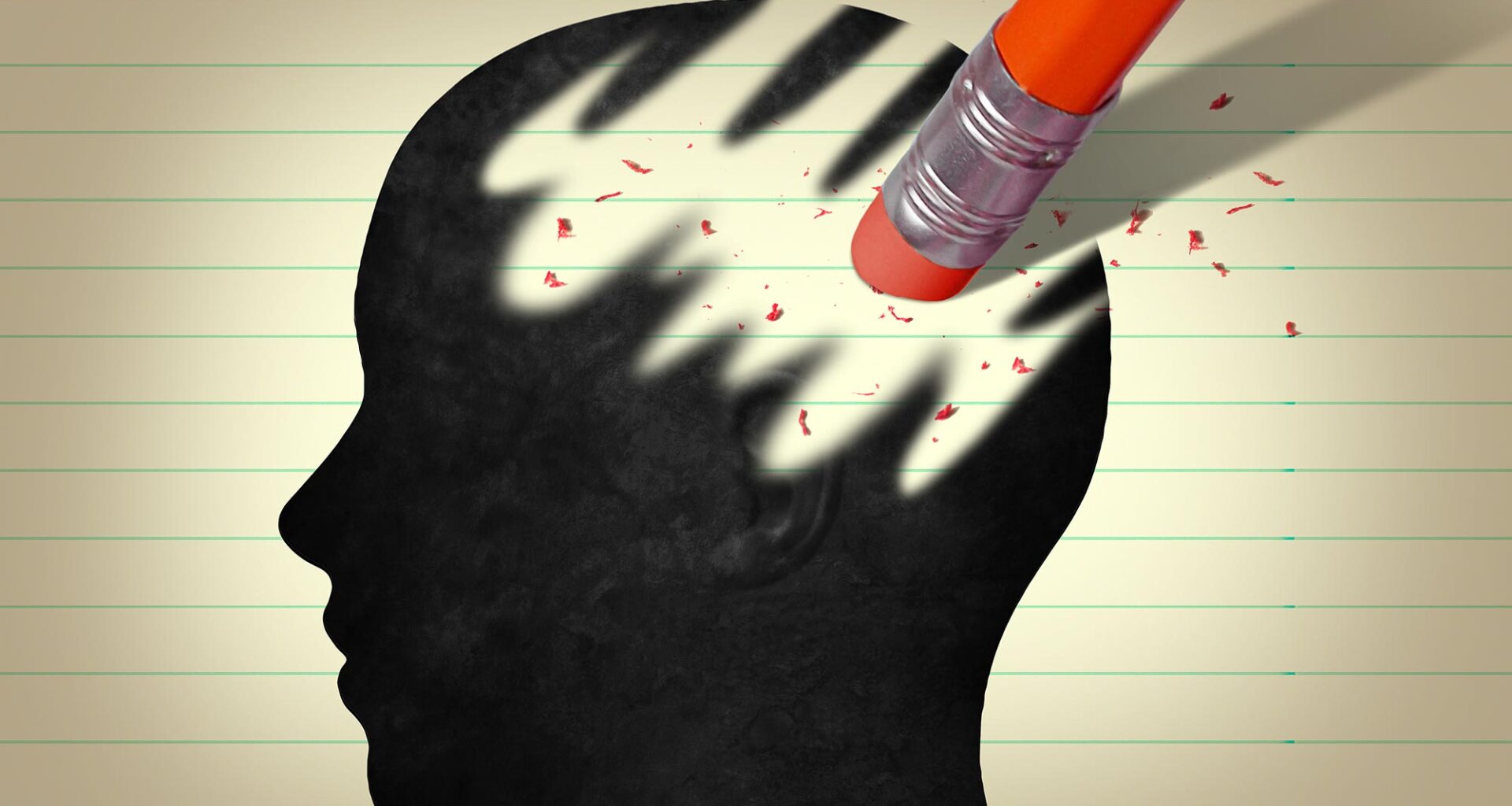 Brain Dementia Erasure Alzheimer