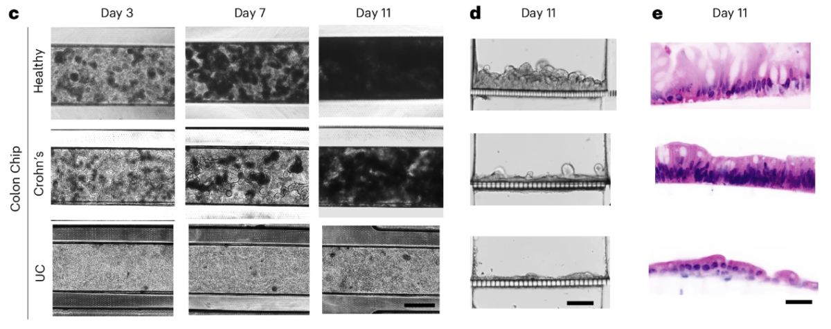 Scientists Build an 'Inflammatory Bowel Disease-on-a-Chip' That Could Transform Research