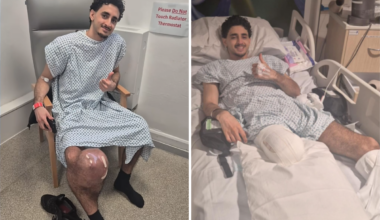 Man Notices Small Lump on Knee, Then Faces Life-Saving Decision