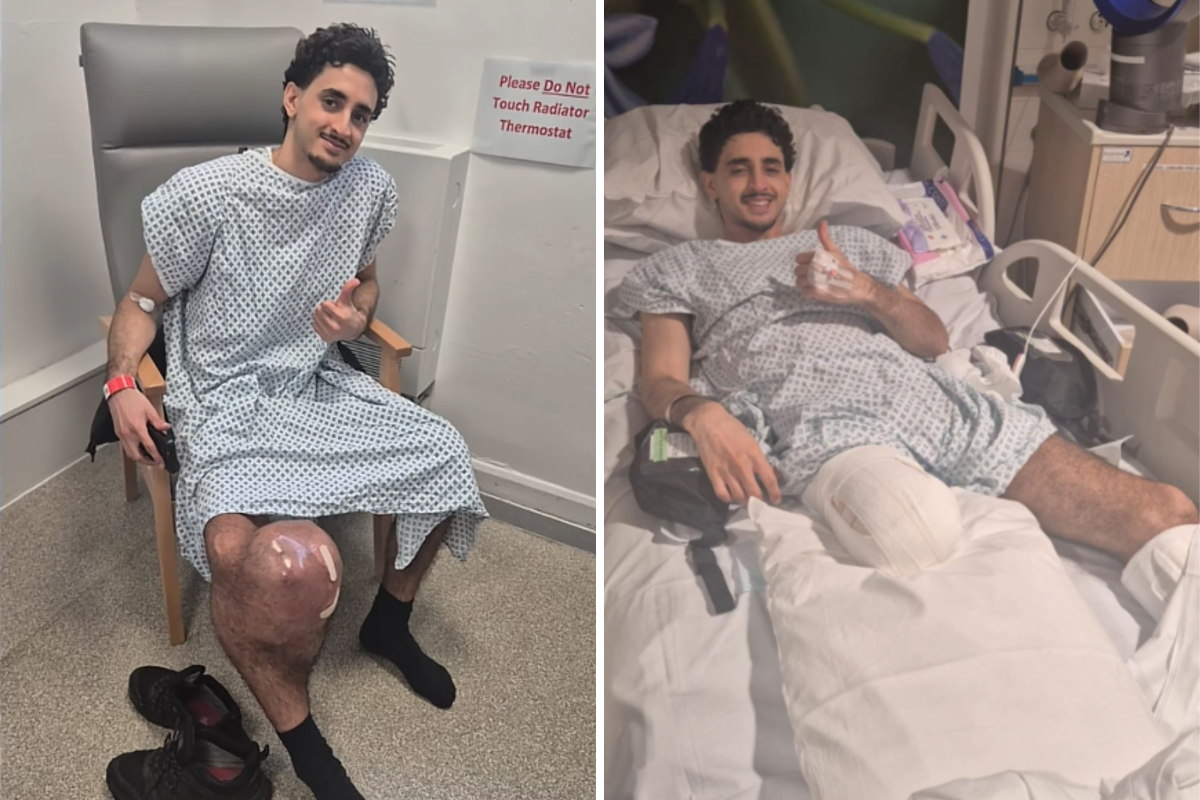 Man Notices Small Lump on Knee, Then Faces Life-Saving Decision
