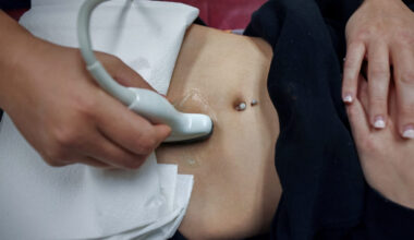 Why doctors say abortion bans are worsening medical care during miscarriages