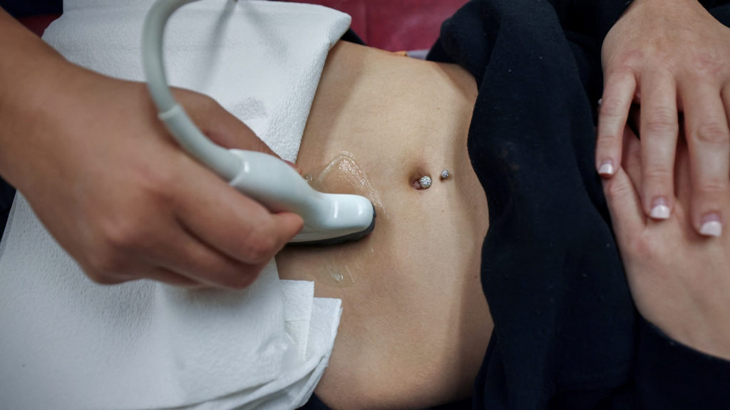 Why doctors say abortion bans are worsening medical care during miscarriages