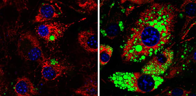 Fat cells